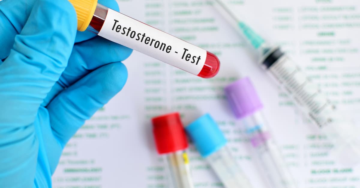 Low Libido and Fatigue? It Could Be Low Testosterone